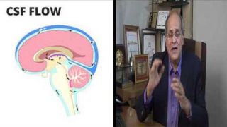 Dr Alok Sharma answering your questions on Stroke, Bone Marrow-Derived Cell Treatment, its safety and results.