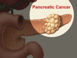 digestive system doctors in mumbai Liver and Pancreas Clinic - Liver and Pancreas Specialist in Mumbai, India