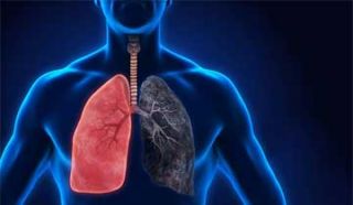 pulmonary oedema specialists mumbai Dr Parthiv Shah - Chest physician | Lung specialist | TB Specialist | Pulmonologist in Borivali