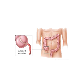 The appendix is a long narrow tube about a few inches in length that attaches to the first part.