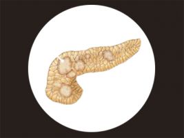 gastric ulcer specialists mumbai Liver and Pancreas Clinic - Liver and Pancreas Specialist in Mumbai, India