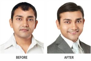 hair analysis mumbai Richfeel Trichology Centre