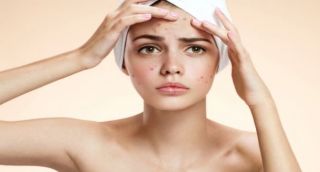 All You Need To Know About the Acne Treatment in India