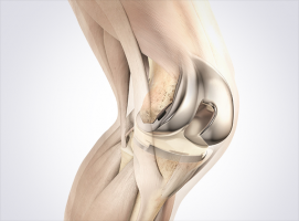 knee specialists in mumbai Dr. Santosh Shetty Best Knee and Hip Joint Replacement Surgeon. Joint Pain Specialist Clinic. Best Orthopedic Surgeon Malad Mumbai