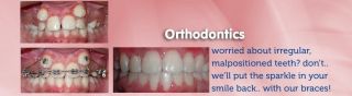 orthodontic clinics mumbai Dr. Vashi's 'The Braces Point'