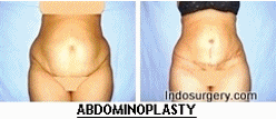 breast enlargement clinics mumbai Botox