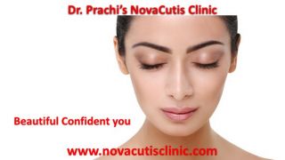 carboxitherapy mumbai Dr. Prachi's NovaCutis Skin & Cosmetic Clinic